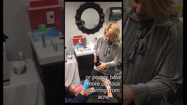 Treatment Video: Microneedling with PRP (Platelet Rich Plasma) смотреть онлайн