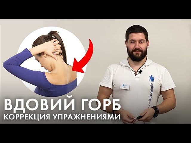 Вдовий горбик: как избавиться? Упражнения от холки на шее для женщин и мужчин