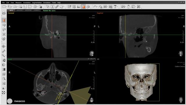 Возможности программы Ez3D: как настраиваться на ВНЧС смотреть онлайн
