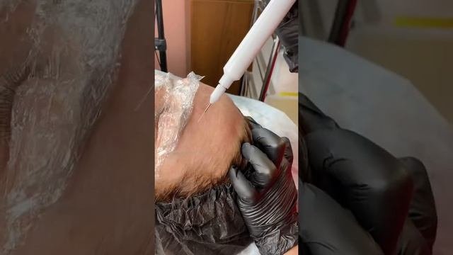 Холодная плазма обучение.