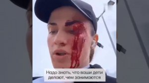 На уроженку Чечни Аминат Эльбукаеву котрая профессионально занимается боксом напала толпа мужиком.