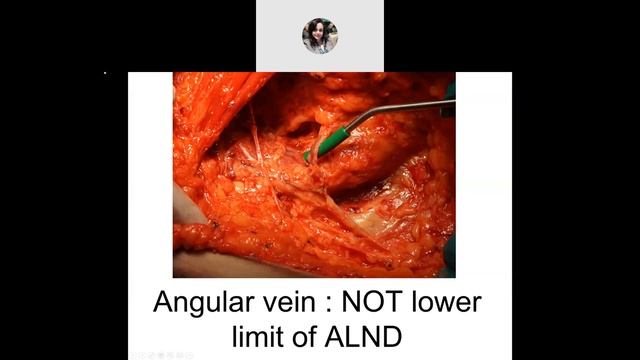 Axillary Lymph Node Dissection смотреть онлайн