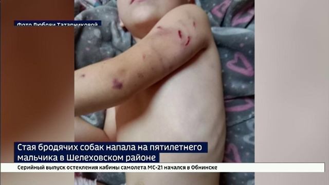 Стая бродячих собак напала на пятилетнего мальчика в Шелеховском районе смотреть онлайн
