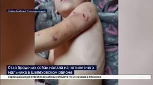 Стая бродячих собак напала на пятилетнего мальчика в Шелеховском районе