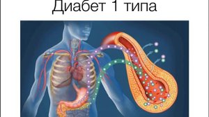 Что такое диабет 1 типа простым языком