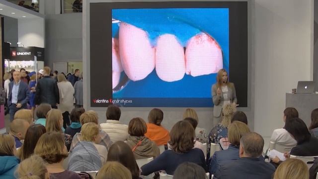 Простые подходы в реставрации передних зубов композитным материалом смотреть онлайн