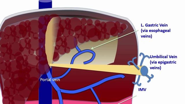 USMLE RX - 4.Желудочно-кишечный тракт - 1.Анатомия - 13.Портосистемные анастомозы (портокавальные)