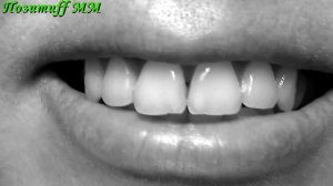 Домашнее отбеливание зубов АКТИВИРОВАННЫМ углем. ЭФФЕКТ заметен СРАЗУ!