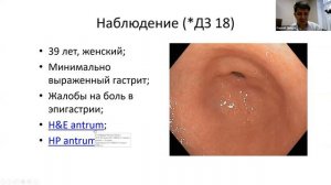 Морфология гастритов