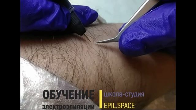 Электроэпиляция на руке, работа мастера -основателя школы EPIL.SPACE смотреть онлайн