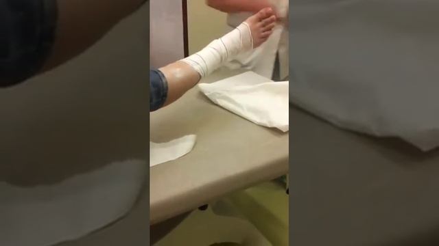 Cнимает гипс смотреть онлайн