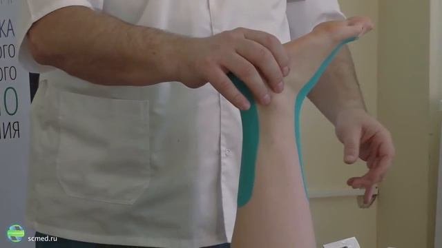 Кинезиотейпирование. Голеностоп растяжение. Инструкция