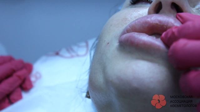 7 КОРРЕКЦИЯ ГУБ ЧТО ДЕЛАТЬ смотреть онлайн