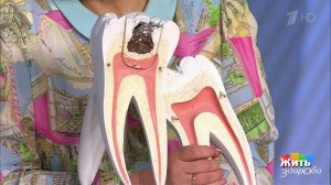 Кариес у детей. Жить здорово! Фрагмент выпуска от 13.07.2017