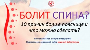 Болит спина? 10 причин боли в пояснице и что можно сделать?
