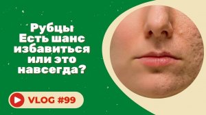 РУБЦЫ / Есть шанс избавиться или это навсегда