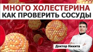 Высокий общий холестерин. Хороший и плохой холестерин. Остаточный холестерин. Низкие триглицериды. Ч