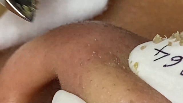 Enjoy Your Day With Hien Nguyen Spa # 1660 смотреть онлайн