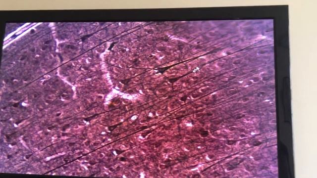 Кора больших полушарий. Гистология смотреть онлайн