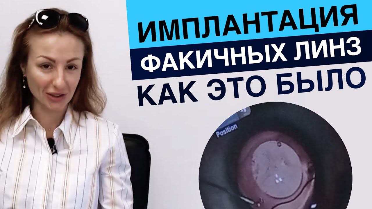 Имплантация факичных интраокулярных линз. Отзыв пациента.