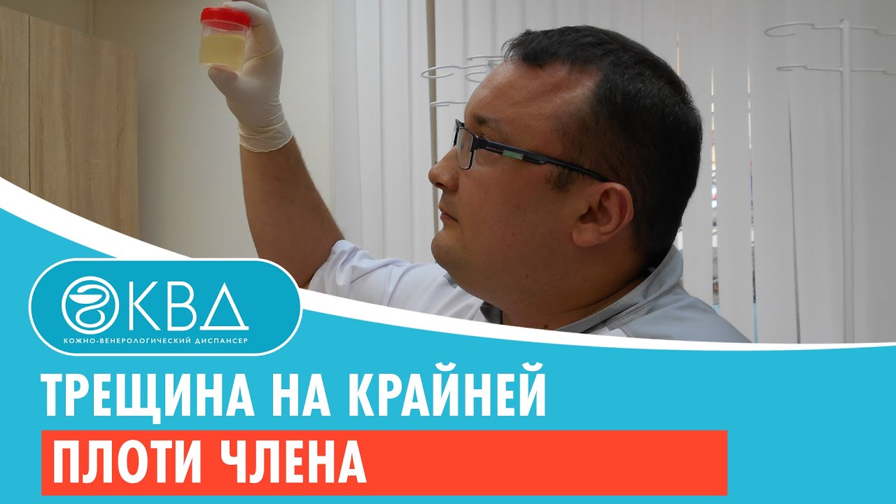 ? Трещина на крайней плоти члена. Клинический случай №279