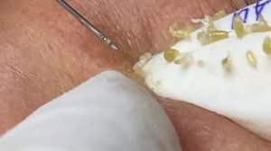 Enjoy Your Day With Hien Nguyen Spa # 1909