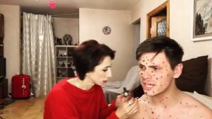 Мама и сын «Ветрянка» (#gan_13_)