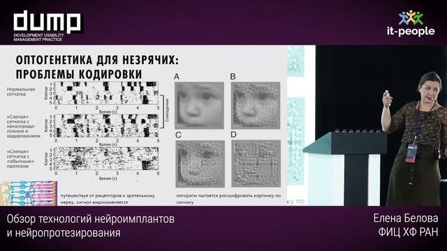 Обзор технологий нейроимплантов и нейропротезирования. Елена Белова, ФИЦ ХФ РАН
