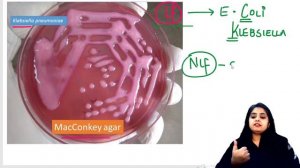 Revise with Dr. Preeti - Q 36 - Q 50 - Pathology & Microbiology for FMGE & NEET PG 2023