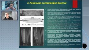 Гипертрофия разных участков бицепса. Можно ли тренировать часть мышцы отдельно?