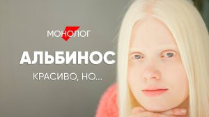 Рядом со мной ЗАГАДЫВАЮТ ЖЕЛАНИЯ - #монолог АЛЬБИНОСА