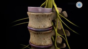 Что такое Люмбоишалгия? | NPClinic