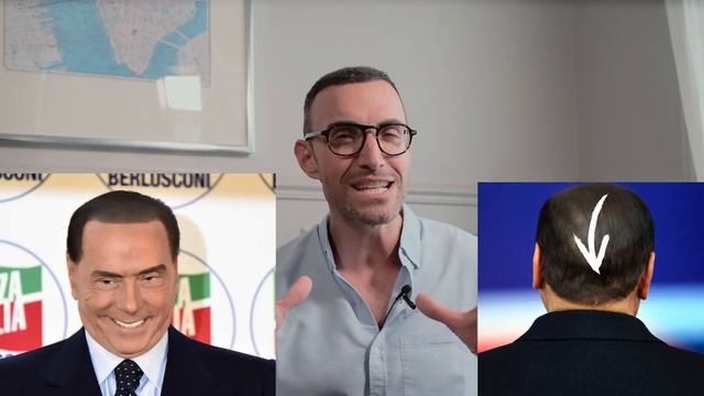 8 Techniques de PRO pour Cacher une Calvitie (Macron a sa technique ?) смотреть онлайн