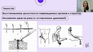 КАК правильно выполнить ПХО?