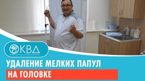 ✅ Удаление мелких папул на головке. Клинический случай №1049