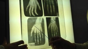 Рентген кисти