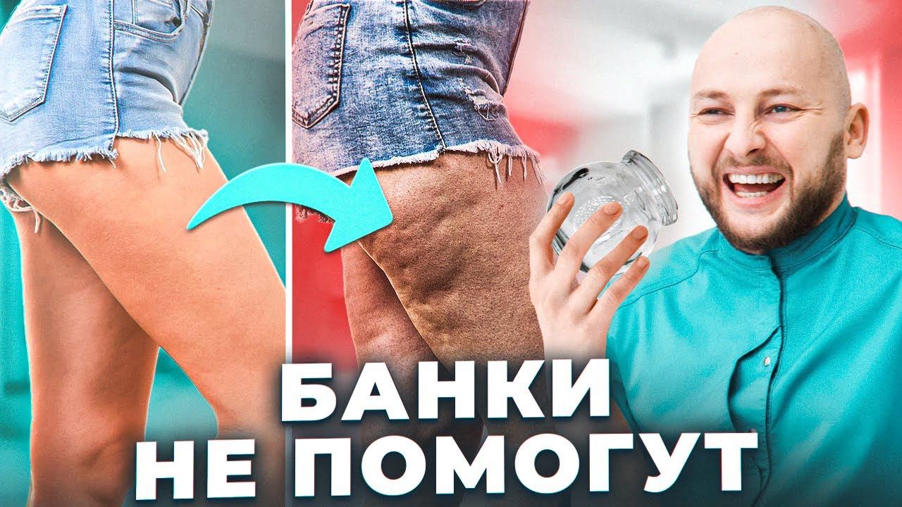 Вся правда про целлюлит | Самые опасные способы лечения | Косметология в Москве