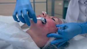 Мезороллер Mesoline