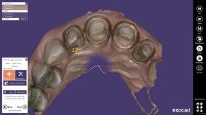 exocad Video Tutorial: Model Creator