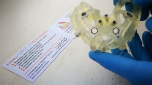 Планирование, изготовление разборных хирургических шаблонов Нижний Новгород