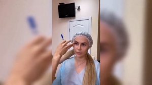 Верхняя Блефаропластика. Upper Blepharoplasty ★ DUZHY