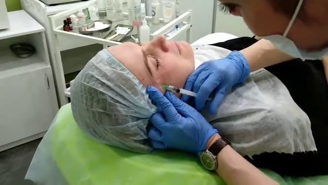 Биоревитализация вокруг глаз. Клиника косметологии Аши