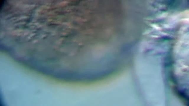 Brachionus calyciflorus Dark field смотреть онлайн