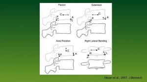 Lumbale Spinalkanalstenose II: Exkurs Biomechanik