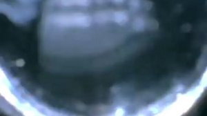 Endoscopy of BAC engine VW Touareg 2.5 R5TDI