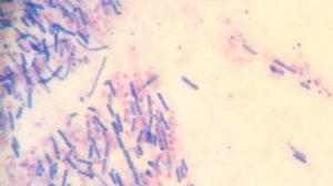 Bacillus subtilis (Ozheshko method | Окр. по Ожешко)