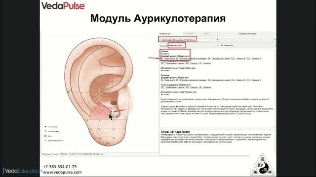 Аурикулотерапия: возможности метода и программного модуля «ВедаПульс»