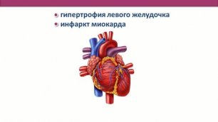 Чем опасна артериальная гипертония