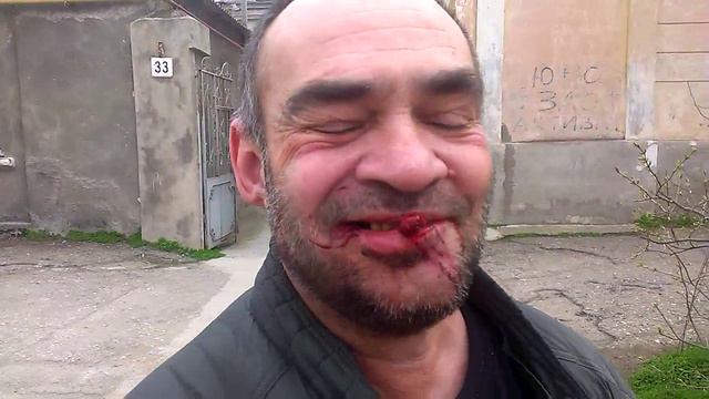 Укусил французский бульдог смотреть онлайн