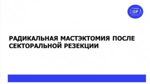 Радикальная мастэктомия после секторальной резекции